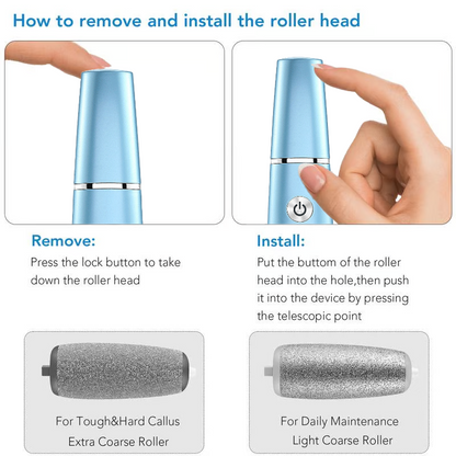 Electric Feet Callus Remover?