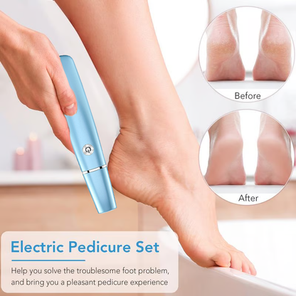 Electric Feet Callus Remover?