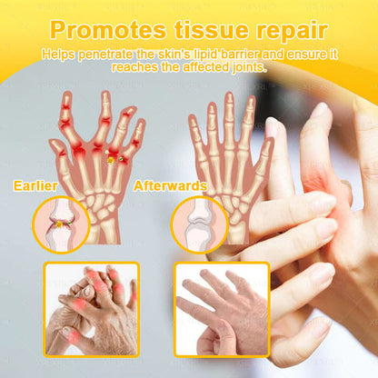 KLENIMORE® Bee Venom Pain-Relief Bone Healing Cream 🇺🇸(Specially for older adults)