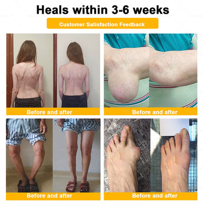KLENIMORE® Bee Venom Pain-Relief Bone Healing Cream 🇺🇸(Specially for older adults)