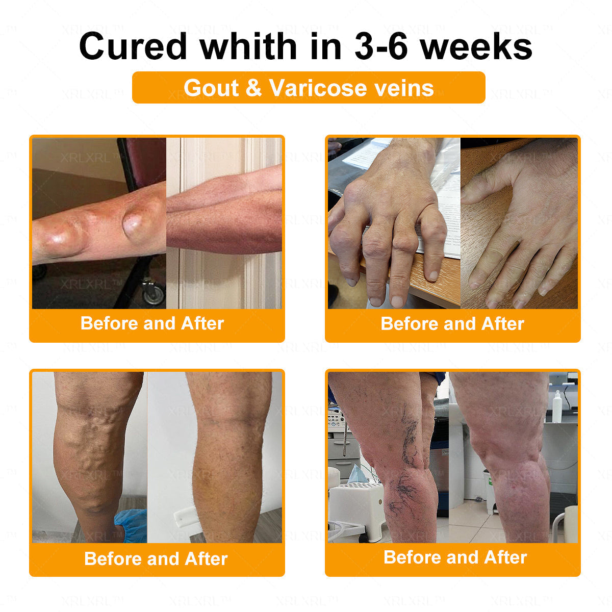 KLENIMORE® Bee Venom Pain-Relief Bone Healing Cream 🇺🇸(Specially for older adults)