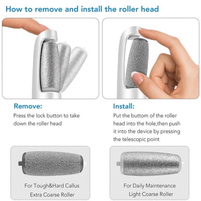 Electric Feet Callus Remover?