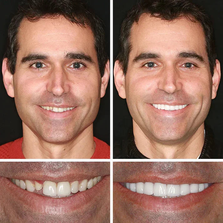 Male smile appearance comparison