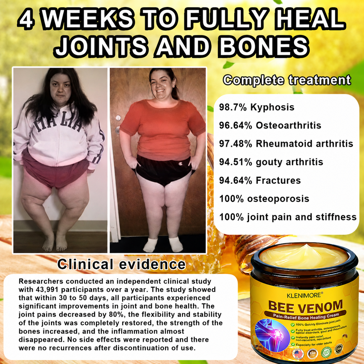 KLENIMORE® Bee Venom Pain-Relief Bone Healing Cream 🇺🇸(Specially for older adults)