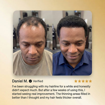 KLENIMORE™ Batana Hair Growth Oil for Thinning Hair & Receding Hairlines