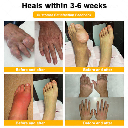 KLENIMORE® Bee Venom Pain-Relief Bone Healing Cream 🇺🇸(Specially for older adults)