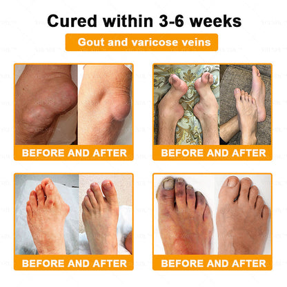 KLENIMORE® Bee Venom Pain-Relief Bone Healing Cream 🇺🇸(Specially for older adults)