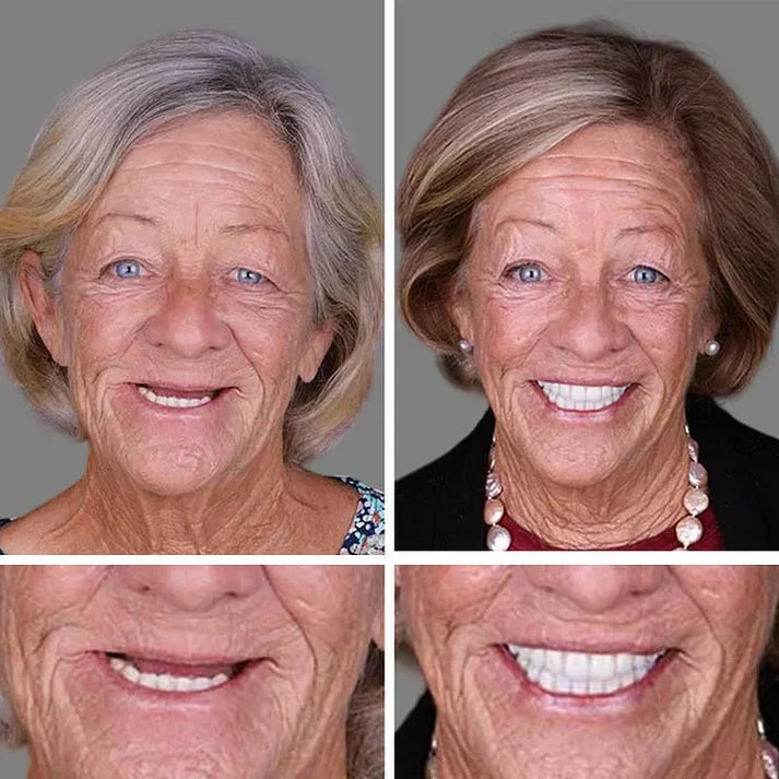 🏆Ends Today: Exclusive Smile Care Offer! 🏆2026 Bestselling Product🦷 Fresh Smile Comfort, Say Goodbye to Wearing Discomfort!🌎