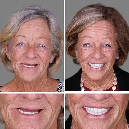 🏆Ends Today: Exclusive Smile Care Offer! 🏆2026 Bestselling Product🦷 Fresh Smile Comfort, Say Goodbye to Wearing Discomfort!🌎