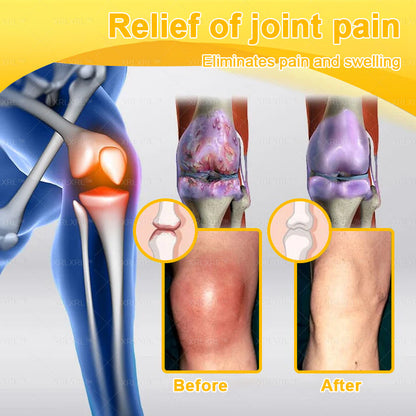 KLENIMORE® Bee Venom Pain-Relief Bone Healing Cream 🇺🇸(Specially for older adults)