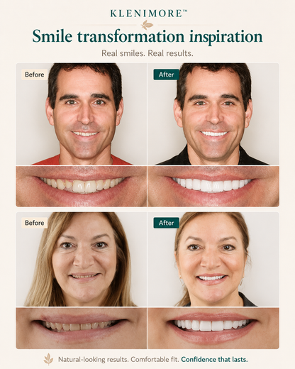 Custom-Fit Instant Smile Dentures – Natural Looking Comfort Fit