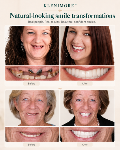 Custom-Fit Instant Smile Dentures – Natural Looking Comfort Fit