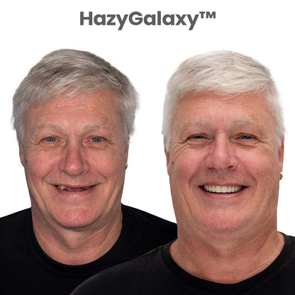 ⏰⏰ HazyGalaxy™ Custom-Fit Dentures ⏰ ENDS TODAY   70% OFF | Smile with Confidence