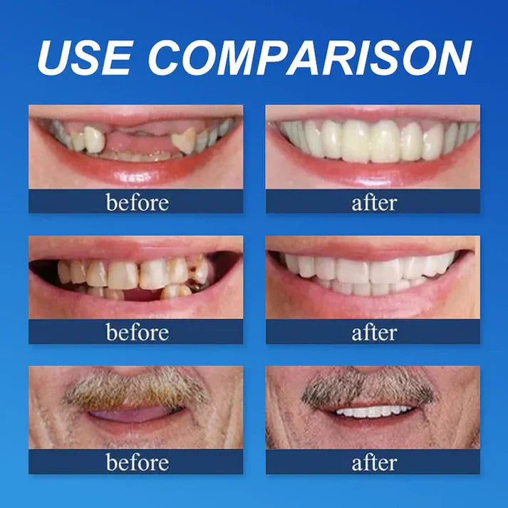 Smile use comparison